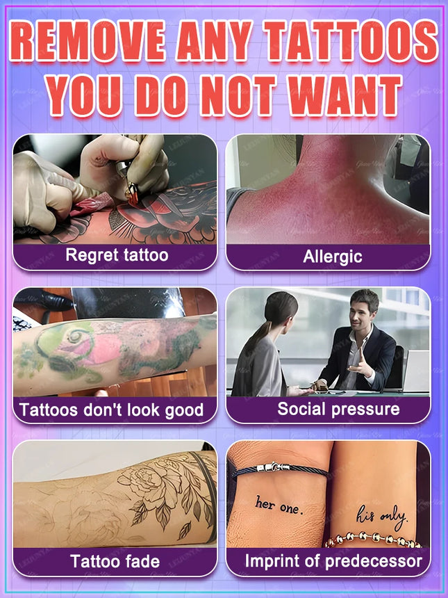 Fast and effective tattoo removal, no laser required, no pain, no scarring