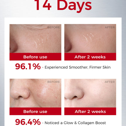 3pcs Retinol Face Essence: Boost Firmness, Brightness & Moisture with Carnosine & Centella Extract