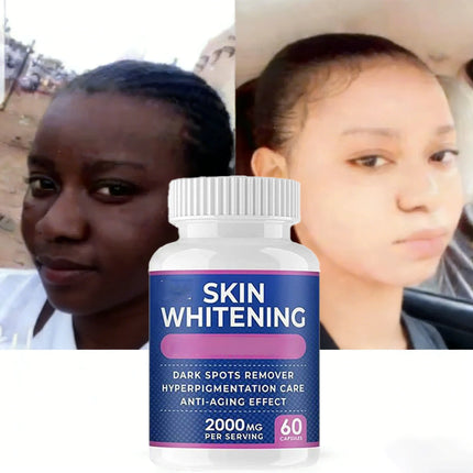 Face Body Remove Dark Spots Eliminate Melanin Dispel Acne Lighten The Skin,smooth delicate skin brightens and removes blemishes