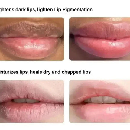 Remove Dark Lip Balm Moisturizing Lighten Melanin Bleaching Lip Gloss Lip Pink Lipstick Exfoliating Fade Lip Line Beauty Health