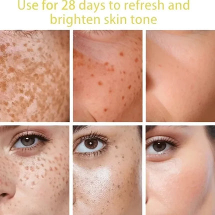 Powerful Dark Spots Remover Freckle Whitening Serum Melanin Correcting Anti Pigmentation Brighten Korean Day Night Facial Care