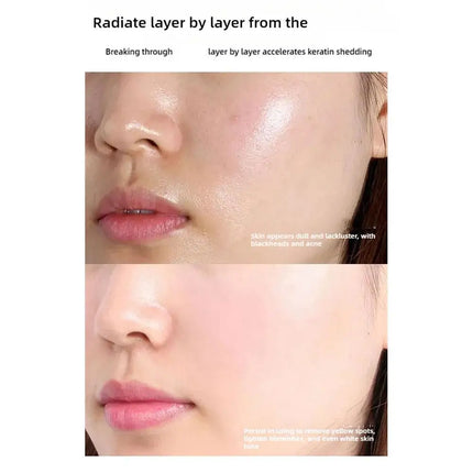 Spots Peel-Off Facial Mask Anti-Blemish Freckle Brightening Off Mask Deeply Clean Pore Tightening Moisturize Glowing Skin