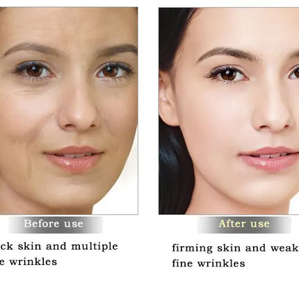 ARTISCARE Snail Face Cream + Peptide Eye Roller + Golden Eye Cream 3Pcs for Facial Moisturizing Serum Dark Circles Eye Care