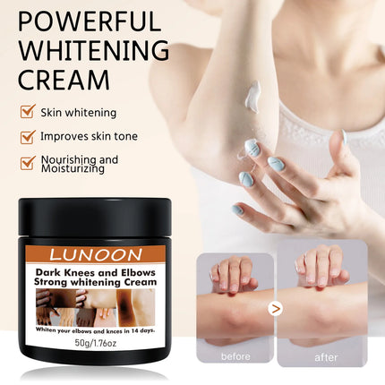 2/1pcs Body Whitening Cream Underarm Bleaching Serum Intense Whiten Butt Knee Brighten Inner Thigh Intimate Dark Remove Melanin