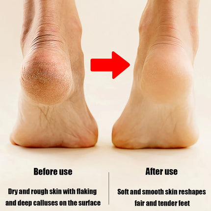 Electric Foot Callus Remover, Professional Electric Callus Remover, Rechargeable Portable Electronic Foot File Pedicure Tool, Electric Callus Remover Kit for Smooth and Soft Feet - Ideal Gift for Care of Hard, Cracked, and Dr