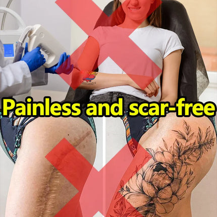 Remove old tattoos with a single click.