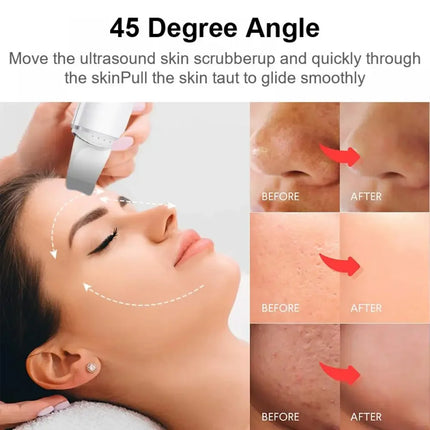 Ultrasonic Skin Scrubber Vibration Face Spatula Blackhead Remover Shovel Clean Cavitation Peeling Facial Lifting skin care Tools