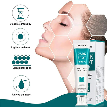 Effective Whitening Freckles Cream Remove Melasma Dark Spots Fade Melanin Pigmentation Moisturizing Brighten Skin Care Products