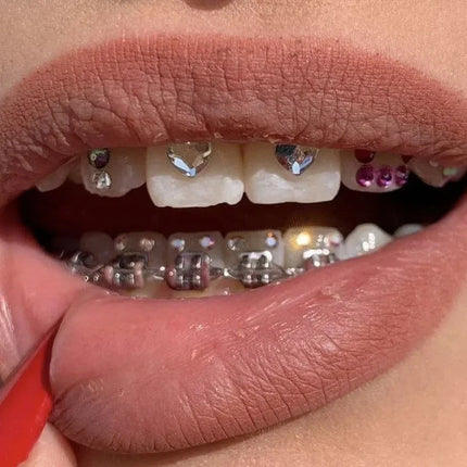 Tooth Gem Kit Glue Professional DIY Teeth Diamond Crystal Jewelry Etching Gel Light Cure Orthodontics Adhesive Bonding Materials
