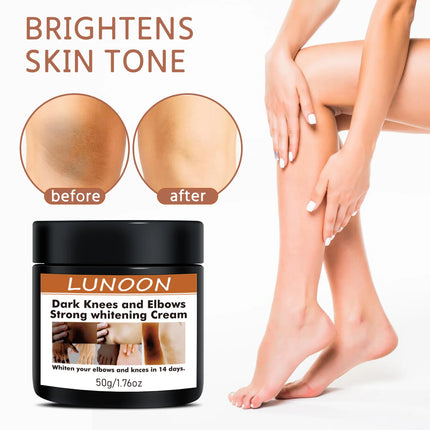 2/1pcs Body Whitening Cream Underarm Bleaching Serum Intense Whiten Butt Knee Brighten Inner Thigh Intimate Dark Remove Melanin