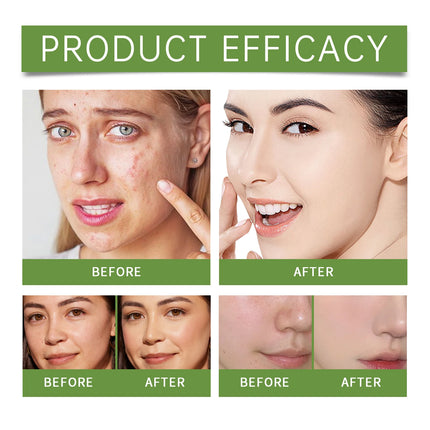 Aloe Vera Face Moisturizing Lotion Nourishing Daily Cream Reduces Dryness & Improves Skin Texture Non-Greasy Glow Skincare