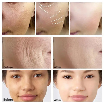 Six Peptide Wrinkle Remove Face Cream Firming Lift Anti-Aging Fade Fine Lines Whitening Moisturizing Smooth Skin Care Products