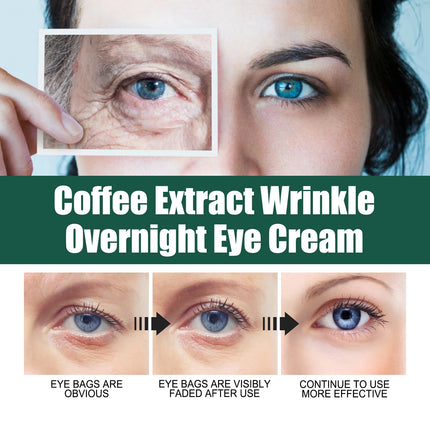 Cordyceps Eye Cream 30g Reduce Wrinkles Appearance Hydrating Brightening Under Eye Treatment Dark Circle Care Firming Eye Cream
