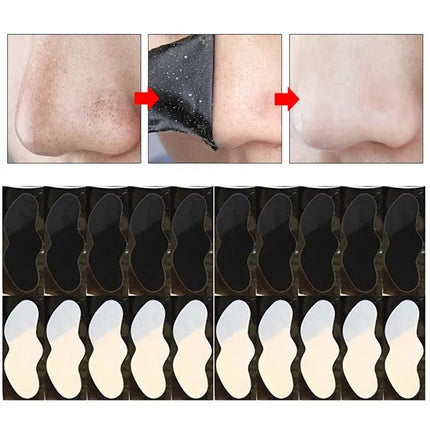 10/20/30/50Pcs White Black Head Remover Nasal Patch Treatment Facial Mask Black Spot Cleaner Nasal Patch Deep Cleaning Skin Care