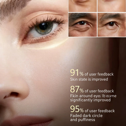 Remove Eye Bag Cream Anti Wrinkle Anti Dark Circle Eye Cream Repair Skin Damage Moisturizing Eye Bags Eyes Skin Care