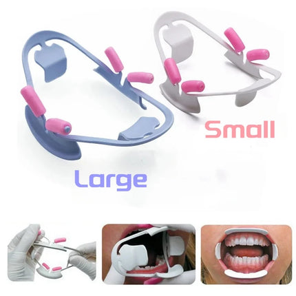 Dental Mouth Opener 3D Oral Lip Cheek Retractor O Shape Orthodontics Tools Dentistry Mouth Gag Lip Retractor Dentists Supplies