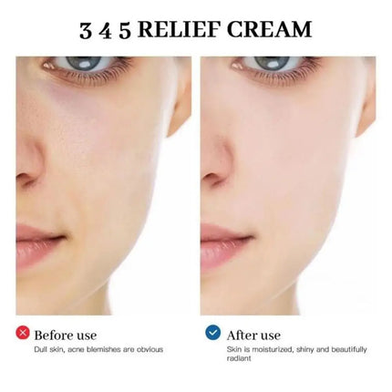 Original Korean Althea Skincare - 345/147 Antioxidant Relief Cream, REJU 5000 Cream, Address Blemishes, Brighten, Barrier Repair