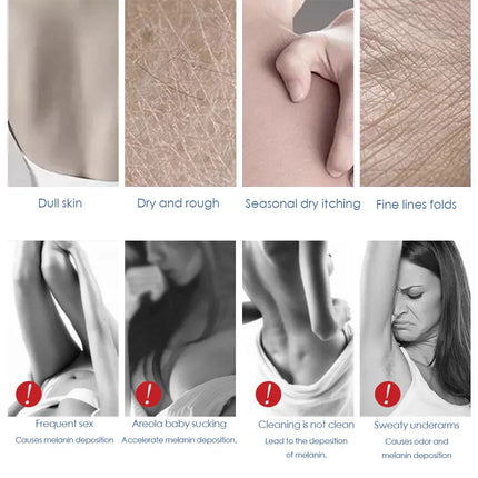 Body Whitening Cream Private Parts Underarm Bleaching Serum Whiten Butt Knee Brighten Inner Thigh Intimate Dark Remove Melanin