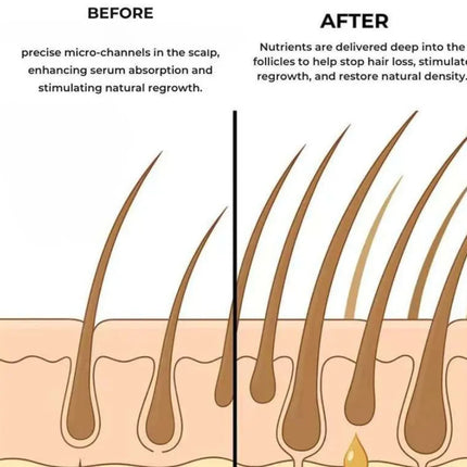 Hair Serum Gentle nourishes the scalp and cares for the softening hair care Daily Care Scalp Serum.