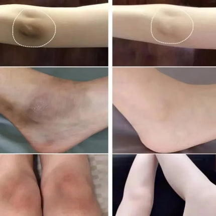 Body Whitening Cream Arms Thighs Underarm Knees Whitening Essence Cream Brighten Moisturizing Body Korean Skin Care Products
