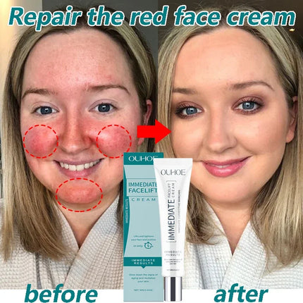 Facial Redness Repair Cream Improve Sensitive Skin Dryness Moisturizer Hydrating Sooth Lotion Removal Rosacea Korean Cosmetics