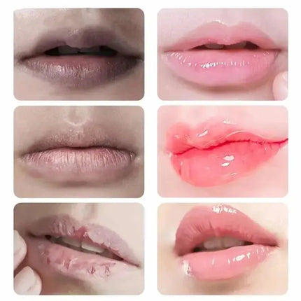 Fast Lightening Pink Mouth Lips Serum Permanent Bleaching Remove Dark Smoke Lips Lip Balm Moisturize Gloss Lipstick Lip Mask