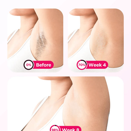 IPL Laser Hair Removal Device Ice-Cooling 3 in 1 Painless 16J Photoepilator Permanent Whole Body Home Treament For Men and Women