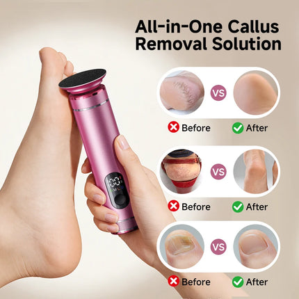 Aluminum Alloy  2 in 1 ElectricFoot Callus Remover with 60pcs Sandpaper Discs, Adjustable Foot File Nail Polisher With Gift Box