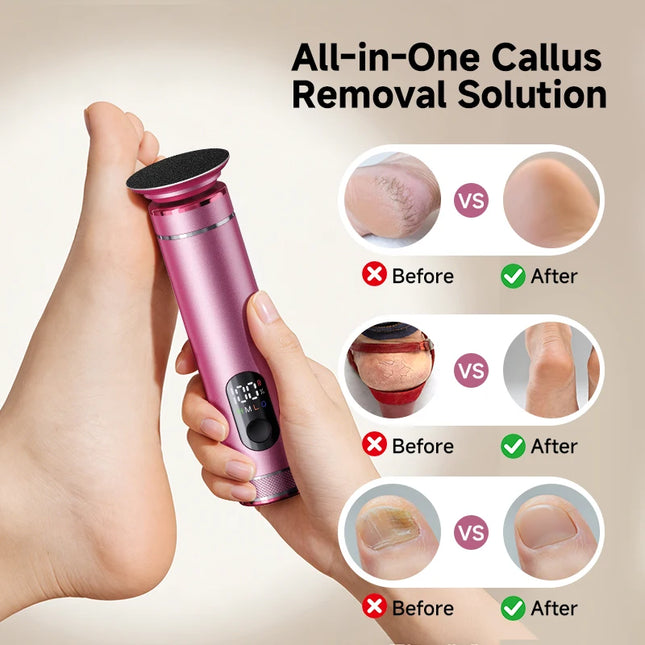 Aluminum Alloy  2 in 1 ElectricFoot Callus Remover with 60pcs Sandpaper Discs, Adjustable Foot File Nail Polisher With Gift Box