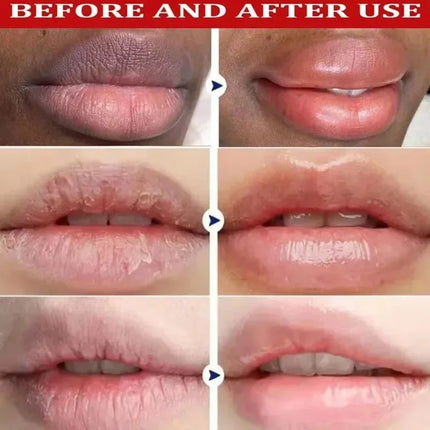 Fast Remove Dark Lip Balm Serum Lighten Melanin Mask Exfoliating Fade Lines Dead Skin Nourishing Repair Care Makeup