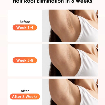 IPL Devices Hair Removal Laser 17J 999900 Light Pulses HR/SC/RA 9 Levels Whole Body Painless Hair Removal Home Use For Men Women