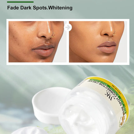 WK JALY Dark Spot Corrector Cream, Lightening Skin, Remove Melanin, Freckles, With Niacinamide, Kojic Acid, For Face And Body