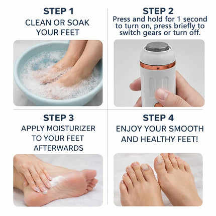 SoftAura Electric Foot Callus Remover Cordless Rechargeable 2 Gears Dry Skin Exfoliation Foot File for Home Pedicure Care