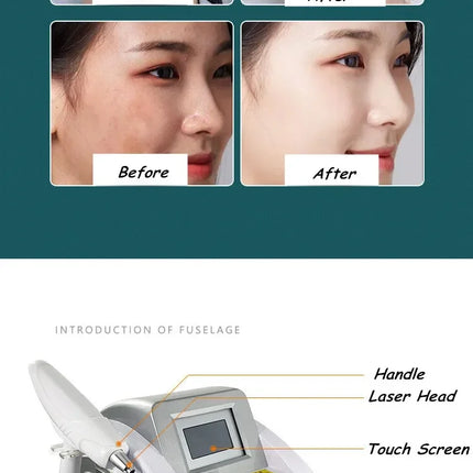 New Hot Product Arrival Eyebrow Washing Machine 1064nm & 532nm Switched Machine Eyebrow Pigment Wrinkle Removal beaut Products