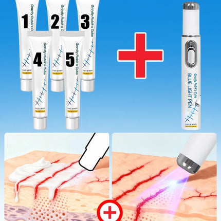 Striae Laser Device Eliminate Body Stretch Marks Products