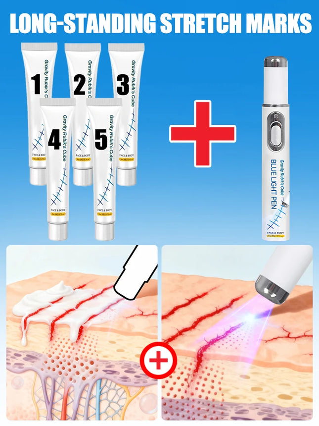 Stretch Mark Laser Removal Device Products