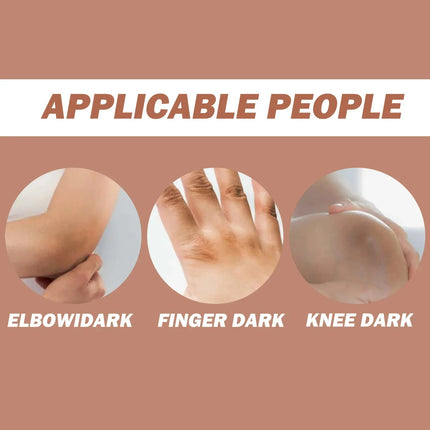 Dark Knuckles Fast Brighten Cream Elbows Hand Knuckle Brightening Serum Knee Black Skin Quickly Lighten Stains Remover Products