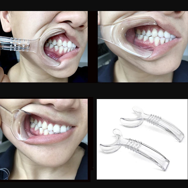 Dental Autoclavable Mouth Opener Orthodontic Lip Cheek Retractor Mouth Spreader Dental Materials dental dentistry tools