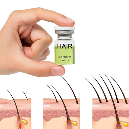 Hair Roller Serum Gentle nourishes the scalp and cares for the softening hair care Daily Care Scalp Serum
