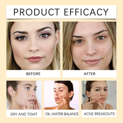 EELHOE Cleansing Remover Oil Facial Makeup Remover Moisturizing Face Refresher Cleaning Centella Asiatica Extract Vitamin E Oil