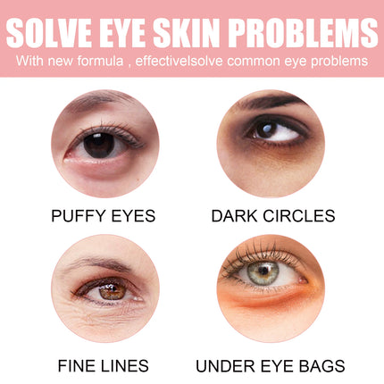 Pink Rose Eye Mask - Anti-Wrinkle & Dark Circle Treatment, Hydrating Under Eye Patches, Firming & Brightening Eye Care