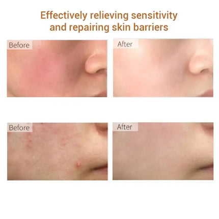 Ectoine Face Serum  Moisturizing Firming Lifting Hyaluronic Acid Collagen Anti-wrinkles Whitening Anti AgingSkin Care Essence