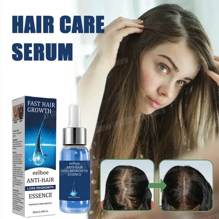 98% of Buyers Buy Again! Hair Care Essential Oils for Thick Hair