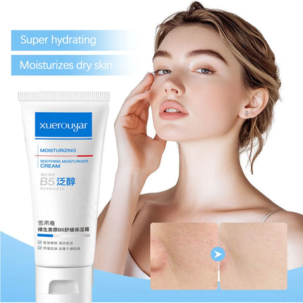B5 Faded Facial Redness Cream Instant Spider Vein Remove Sensitive Skin Sooth Anti Redness Rosacea Treat Lotion Korean Cosmetic