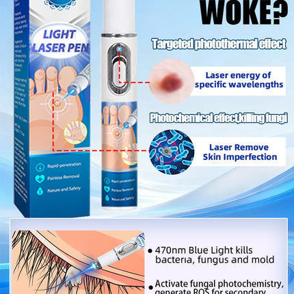 Wart removal pen, skin tag removal pen, suitable for use on the face, neck, hands, and feet.