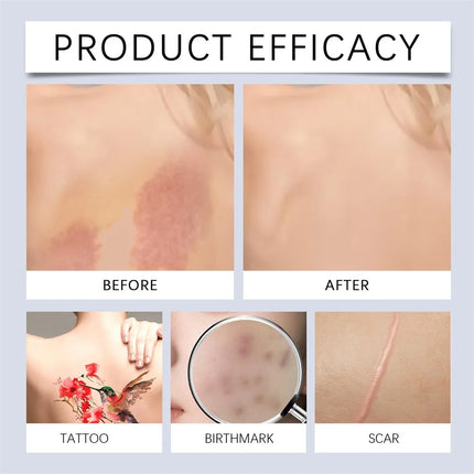 Sweatproof Tattoo Concealer Covers,Waterproof And Durable Skin Concealer,For Dark Spots Vitiligo Scars,Light And Thin