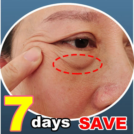 Eye massage instrument, relieve eye fatigue, eliminate eye bags, reduce dark circles, brighten eyes