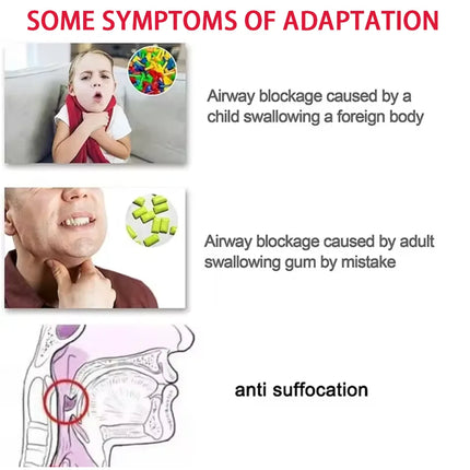 Anti Choking Device New Upgrade Portable Choking Emergency Life Saving Suction Vac Anti Choke Device First Aid Kit for Kid Adult