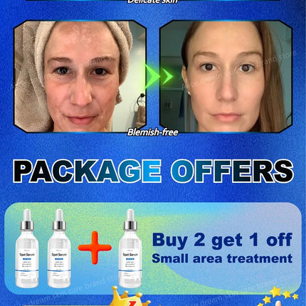 2025 Bestselling Facial Spot-Fading Cream, Effectively Removes Facial Dark Spots