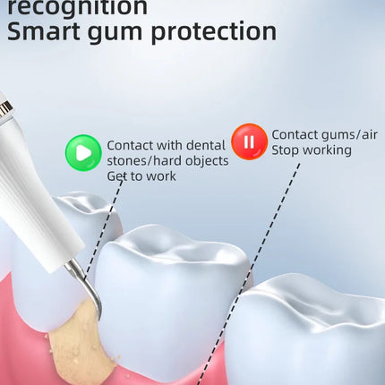 Ultrasonic teeth cleaner, home automatic teeth whitening device, removes tartar and plaque, teeth whitening cleaning tool